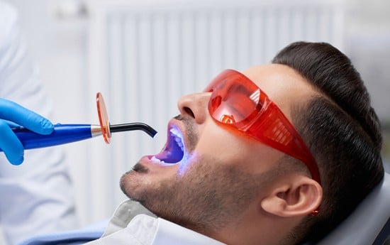 What Are Dental Fillings